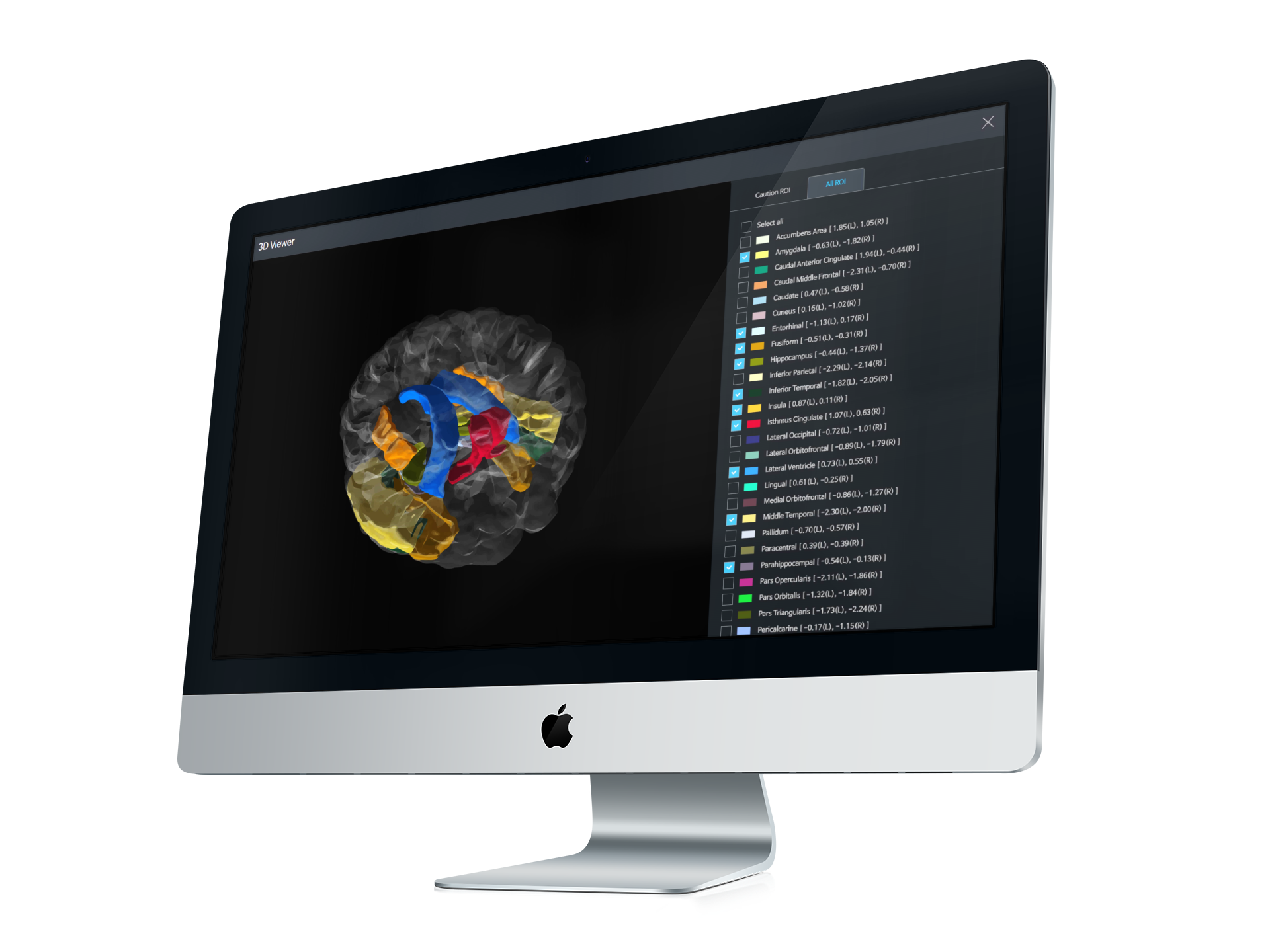 Neuro I Brain Image Quantitative Analysis System UI - 3D viewer